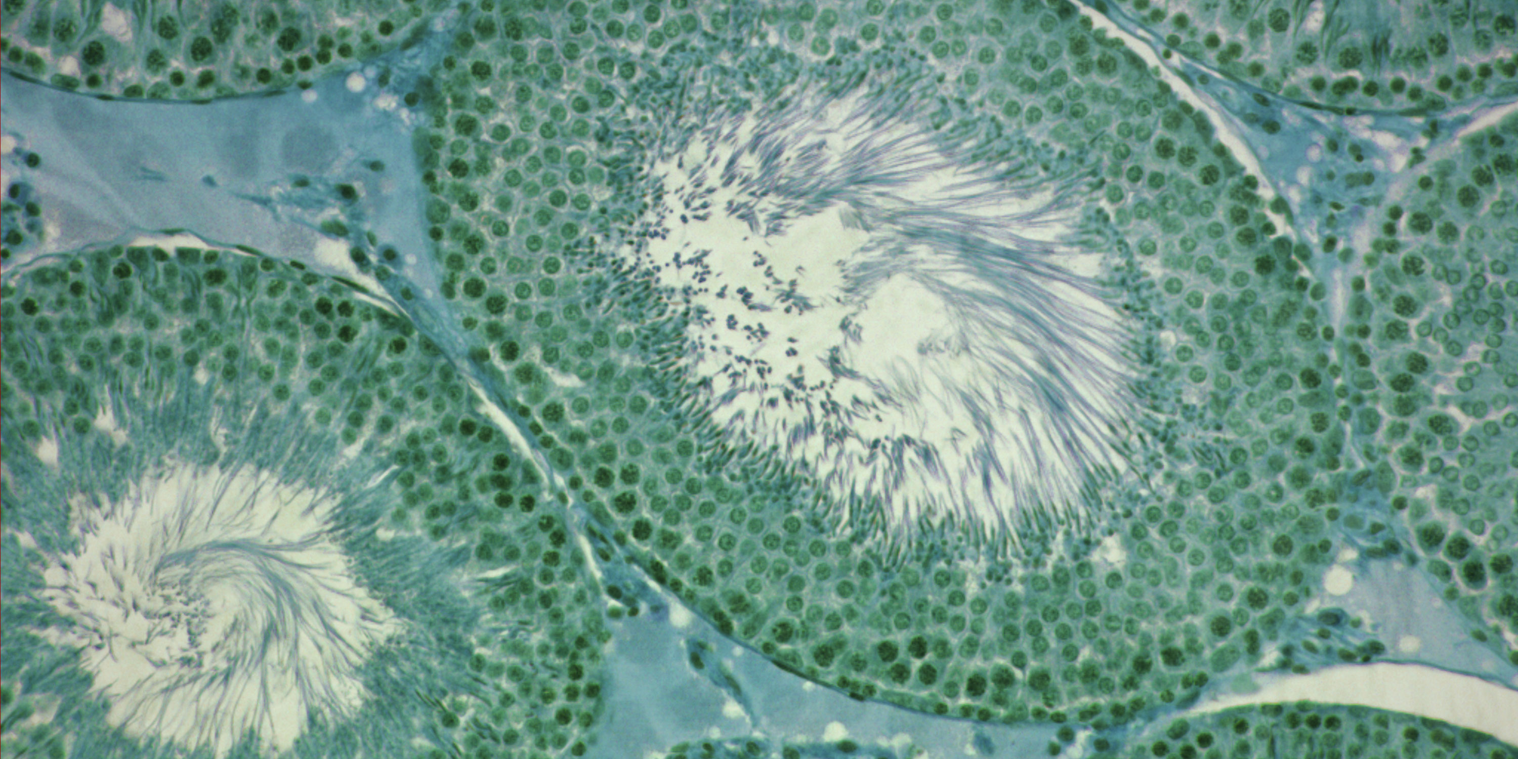 Mikroskopbillede af en rottes testikler. Det indgår i DTU forskning i hormonforstyrrende stoffers skadelige påvirkninger. Og undersøgelser af, hvordan selv små doser kan have markant negativ effekt, hvis de optræder i en kemikaliecocktail.